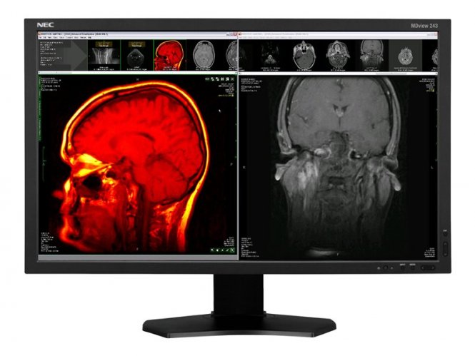 Single MDview243 Solution medical 