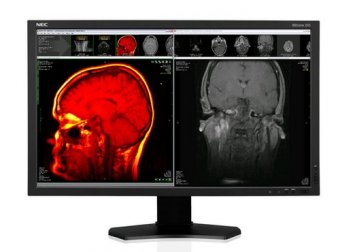 Single MDview243 Solution medical 