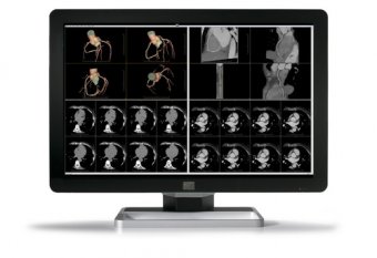 COR C F 6MP NC 30"1H1F EXCL DC 30" 