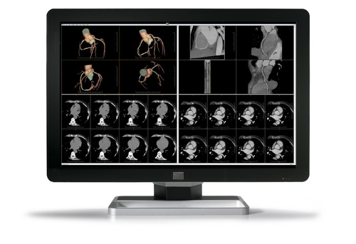 COR C F 6MP NC 30"1H1F EXCL DC 30" 